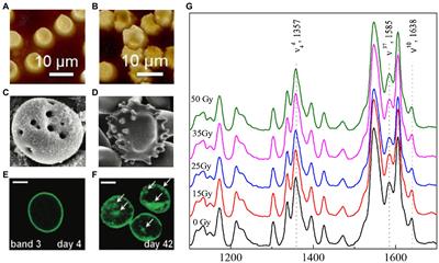 Nanoscale Changes on RBC Membrane Induced by Storage and Ionizing Radiation: A Mini-Review